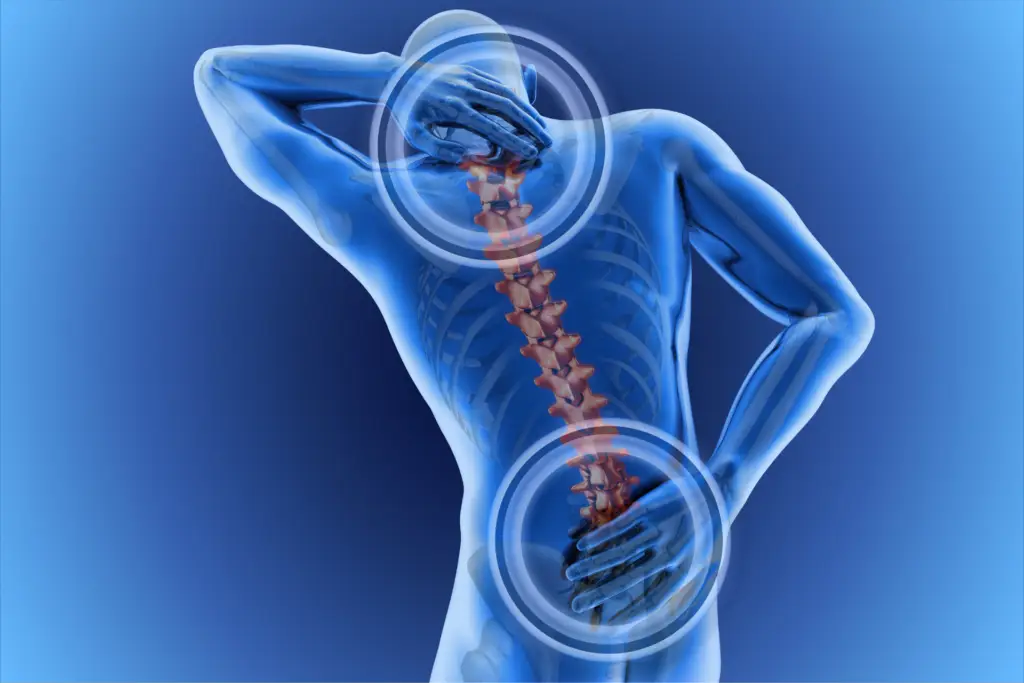 Back Pain Issue