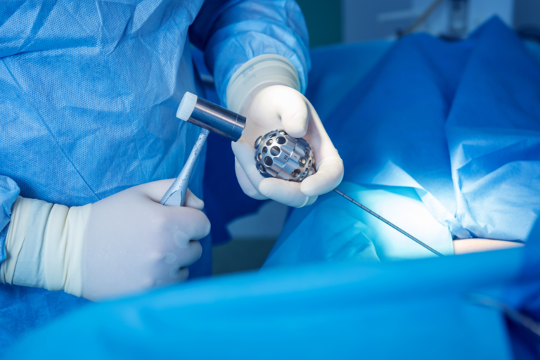 Common Myths About Spine Surgery Treatment in vizag