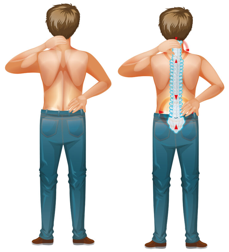 Back Pain Treatment
